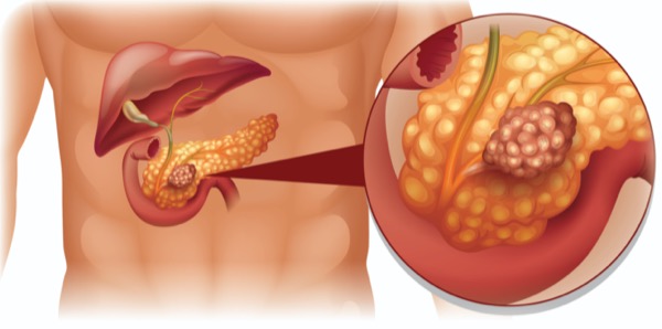 Diagnostic Lab in Chennai